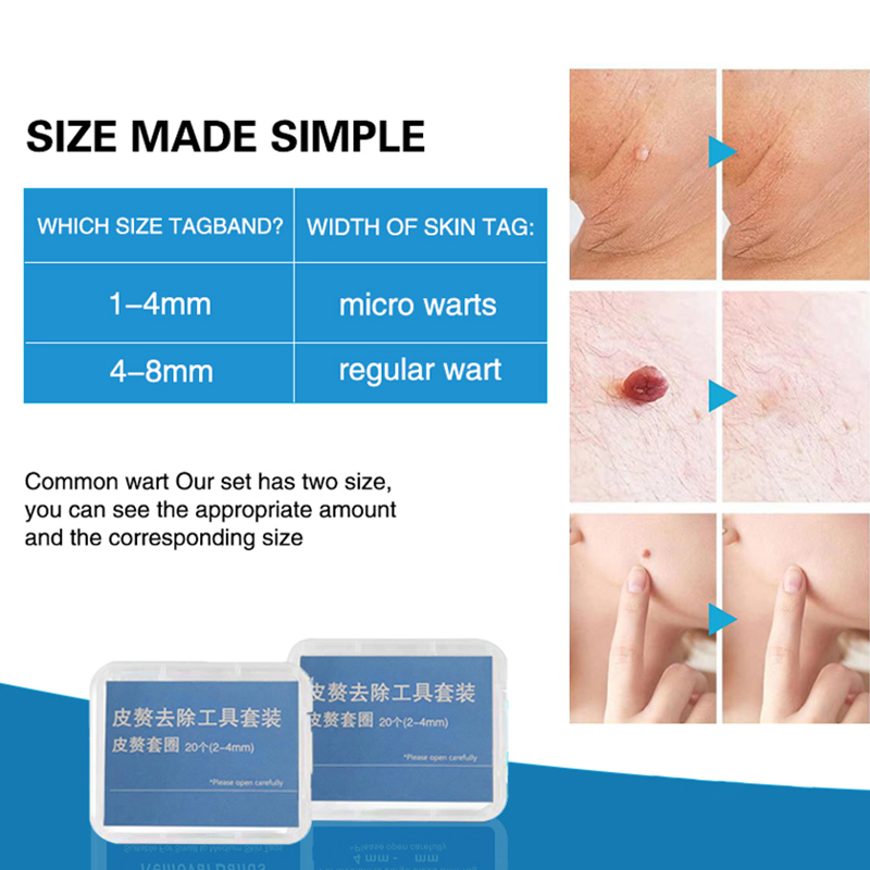 20pcs/Box Flesh Nevus Removal  - Power Tools Organizer 评论和价格